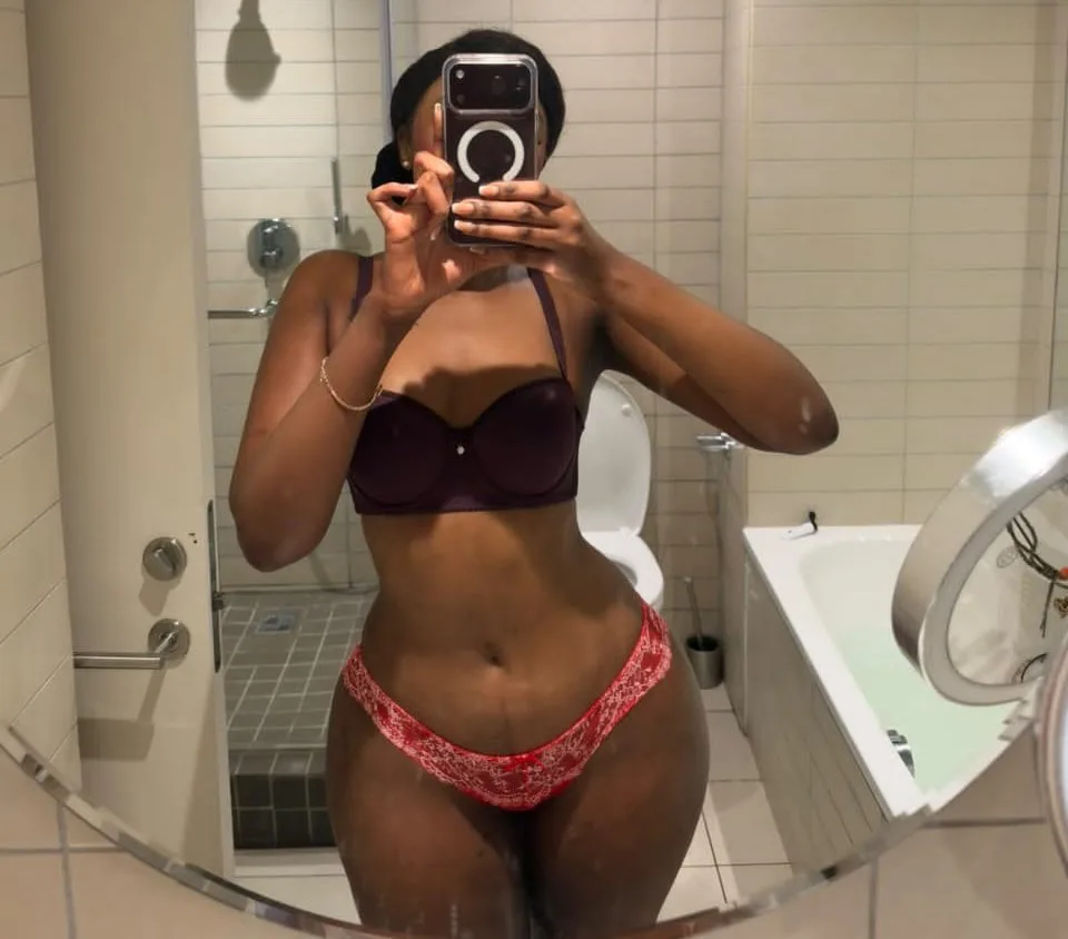 Liposuction · Snatched Waist result