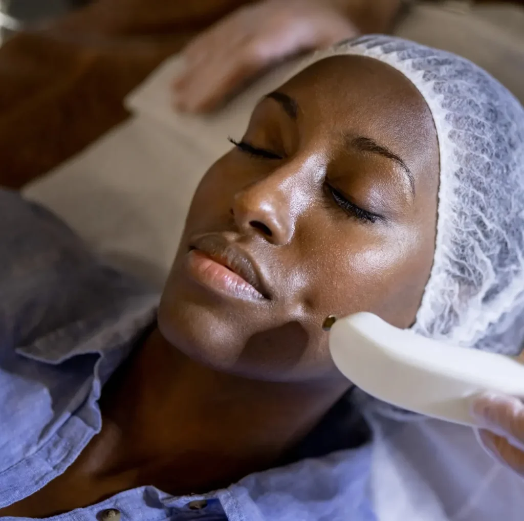 Laser Skin Treatment result